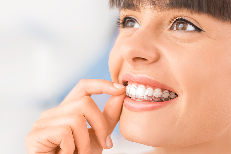 Invisalign in Paramount