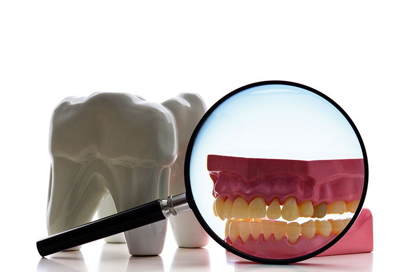 Root Canal Treatment in Paramount